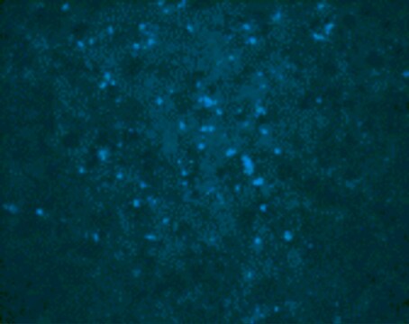 Anti-West Nile Virus Core antibody produced in rabbit affinity isolated antibody