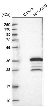 Anti-MMACHC antibody produced in rabbit Prestige Antibodies&#174; Powered by Atlas Antibodies, affinity isolated antibody, buffered aqueous glycerol solution, ab2