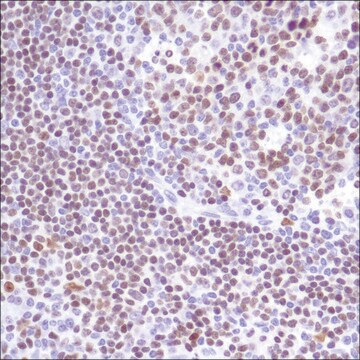 Anti-PU.1 antibody, Rabbit monoclonal recombinant, expressed in proprietary host, clone SP238, affinity isolated antibody