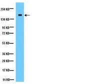 Anti-NMDAR2A Antibody Chemicon&#174;, from rabbit