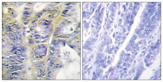 Anti-Collagen IV &#945;5 antibody produced in rabbit affinity isolated antibody