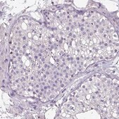 Anti-HTRA4 antibody produced in rabbit Prestige Antibodies&#174; Powered by Atlas Antibodies, affinity isolated antibody, buffered aqueous glycerol solution