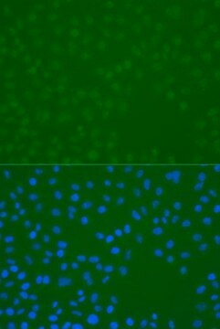 Anti-Phospho-CHEK1-S296 antibody produced in rabbit