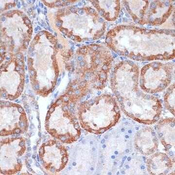 Anti-CLPP antibody produced in rabbit