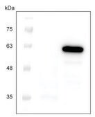 Next Generation Cell Free Protein Expression Kit (Wheat Germ) An Eukaryotic Cell Free Protein Expression system (CFPE/CFPS) with High Yield and Excellent Scalability, 50 reactions