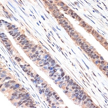 Anti-sestrin 1 antibody produced in rabbit