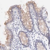 Anti-EBP antibody produced in rabbit Prestige Antibodies&#174; Powered by Atlas Antibodies, affinity isolated antibody, buffered aqueous glycerol solution