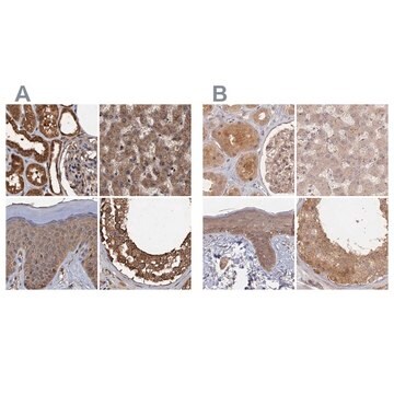 Anti-PSMD9 antibody produced in rabbit Prestige Antibodies&#174; Powered by Atlas Antibodies, affinity isolated antibody, buffered aqueous glycerol solution