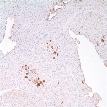 Uroplakin III (AU-1) Mouse Monoclonal Antibody