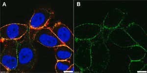Anti-Integrin &#946;1 Antibody, clone P4C10 ZooMAb&#174; Mouse Monoclonal recombinant, expressed in HEK 293 cells