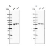 Anti-FGB antibody produced in rabbit Ab1, Prestige Antibodies&#174; Powered by Atlas Antibodies, affinity isolated antibody, buffered aqueous glycerol solution