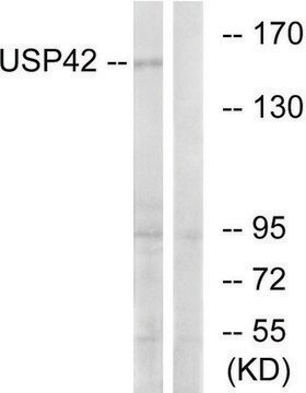 Anti-USP42 antibody produced in rabbit affinity isolated antibody