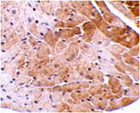 Anti-CIDE-A Antibody from rabbit, purified by affinity chromatography