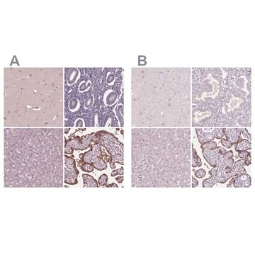 Anti-SIGLEC6 antibody produced in rabbit Ab1, Prestige Antibodies&#174; Powered by Atlas Antibodies, affinity isolated antibody, buffered aqueous glycerol solution