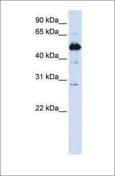 Anti-FAM134B antibody produced in rabbit affinity isolated antibody