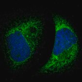 Anti-MTDH antibody produced in rabbit Ab1, Prestige Antibodies&#174; Powered by Atlas Antibodies, affinity isolated antibody, buffered aqueous glycerol solution