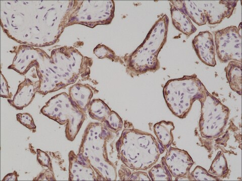 Anti-PLAP antibody, Rabbit monoclonal recombinant, expressed in HEK 293 cells, clone RM317, purified immunoglobulin