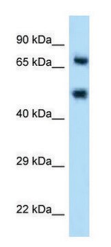 Anti-SELE (N-terminal) antibody produced in rabbit affinity isolated antibody