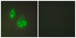 Anti-LAMA3 antibody produced in rabbit affinity isolated antibody