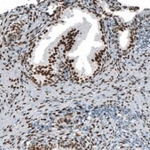 Monoclonal Anti-AR antibody produced in mouse Prestige Antibodies&#174; Powered by Atlas Antibodies, clone CL9255, purified immunoglobulin, buffered aqueous glycerol solution