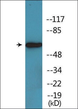 Anti-phospho-RIPK2 (pSer176) antibody produced in rabbit affinity isolated antibody