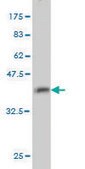 Monoclonal Anti-GMPS antibody produced in mouse clone 1D10, purified immunoglobulin, buffered aqueous solution