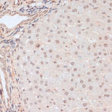 Anti-Phospho-BRCA1-S1423 antibody produced in rabbit