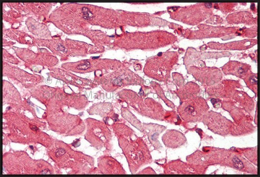 Anti-ACTN2 affinity isolated antibody