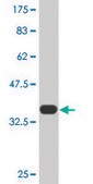 Monoclonal Anti-TF antibody produced in mouse clone 1C2, purified immunoglobulin, buffered aqueous solution