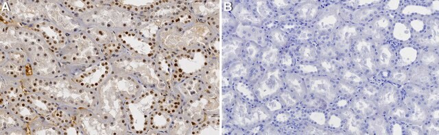 Anti-AP-2&#945; Antibody, clone 1N19 ZooMAb&#174; Rabbit Monoclonal recombinant, expressed in HEK 293 cells