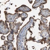 Anti-P2RY1 antibody produced in rabbit Prestige Antibodies&#174; Powered by Atlas Antibodies, affinity isolated antibody, buffered aqueous glycerol solution