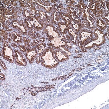 Napsin A Rabbit Polyclonal Antibody