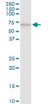 Anti-SLC40A1 antibody produced in rabbit purified immunoglobulin, buffered aqueous solution