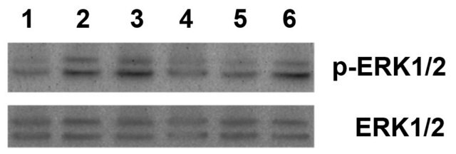 Progranulin mouse recombinant, expressed in HEK 293 cells, untagged, &gt;95% (SDS-PAGE)