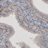 Monoclonal Anti-LAMC1 antibody produced in mouse Prestige Antibodies&#174; Powered by Atlas Antibodies, clone CL3195, purified immunoglobulin, buffered aqueous glycerol solution