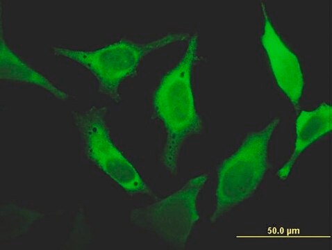 ANTI-FHIT antibody produced in mouse clone 1H2, purified immunoglobulin, buffered aqueous solution