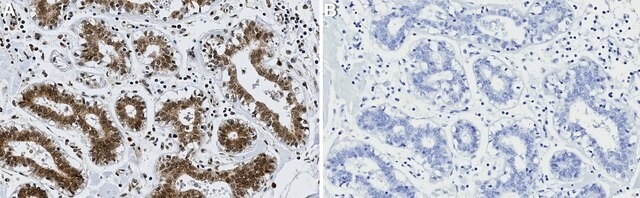 Anti-BRCA2 Antibody, clone 1H2 ZooMAb&#174; Rabbit Monoclonal recombinant, expressed in HEK 293 cells