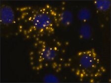 Duolink&#174; In Situ Detection Reagents Orange