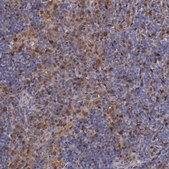 Anti-TYMP antibody produced in rabbit Prestige Antibodies&#174; Powered by Atlas Antibodies, affinity isolated antibody, buffered aqueous glycerol solution