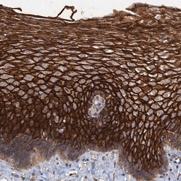Anti-SCUBE3 antibody produced in rabbit Prestige Antibodies&#174; Powered by Atlas Antibodies, affinity isolated antibody, buffered aqueous glycerol solution