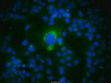 Fetal Bovine Serum US Origin, HL-1 Cell Screened FBS, sterile-filtered, suitable for cell culture