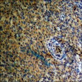 Anti-phospho-Estrogen Receptor-? (pSer87) antibody produced in rabbit affinity isolated antibody
