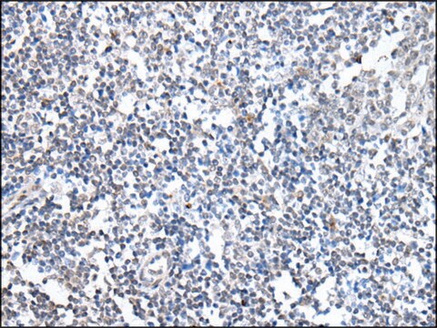Anti-MEN1 affinity isolated antibody