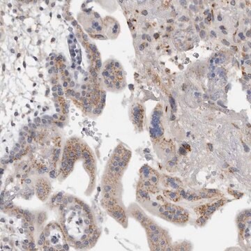 Anti-MGAT1 antibody produced in rabbit Prestige Antibodies&#174; Powered by Atlas Antibodies, affinity isolated antibody, buffered aqueous glycerol solution