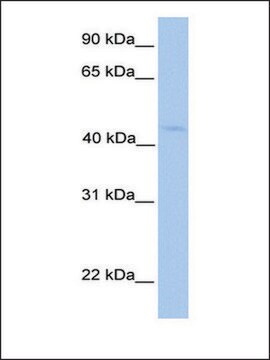 Anti-LIPT1 antibody produced in rabbit affinity isolated antibody