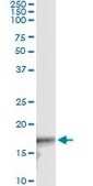 Monoclonal Anti-CDKN2D antibody produced in mouse clone 2E10, purified immunoglobulin, buffered aqueous solution