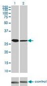 Monoclonal Anti-CDK4 antibody produced in mouse clone 4F11, purified immunoglobulin, buffered aqueous solution