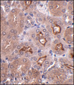 Anti-OTUD5 antibody produced in rabbit affinity isolated antibody, buffered aqueous solution