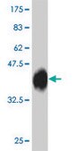 Monoclonal Anti-IKBKB antibody produced in mouse clone 2C3, purified immunoglobulin, buffered aqueous solution
