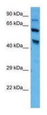 Anti-PDE4D (C-terminal) antibody produced in rabbit affinity isolated antibody